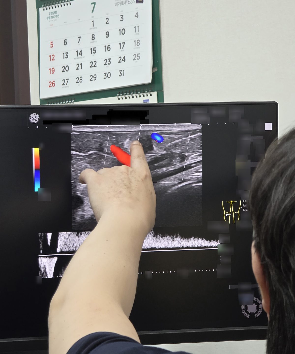 의료진이 초음파 영상이 표시된 모니터를 손가락으로 가리키며 설명하는 장면.