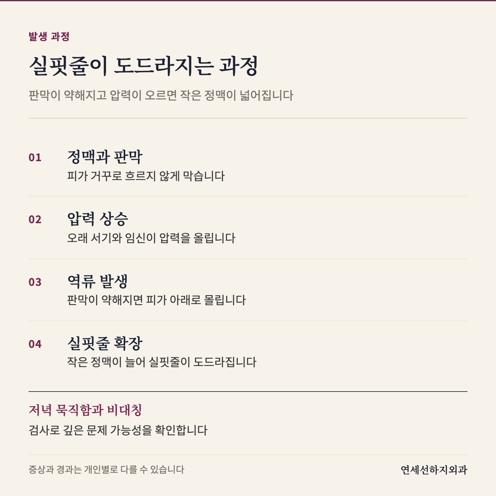 정맥 판막이 약해져 압력이 오르면 작은 정맥이 늘어나 실핏줄이 도드라지는 과정을 4단계로 보여 줍니다. 저녁 묵직함과 한쪽 비대칭은 검사 신호로 표시했습니다.